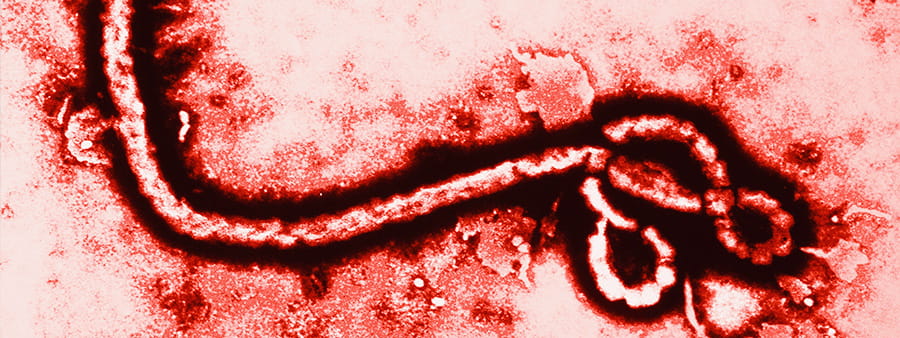 Ebola under microscope photograph